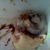 Burger King gallery