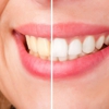 Eagle Rock Dental Care gallery