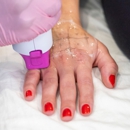 LaserAway East Lansing - Hair Removal