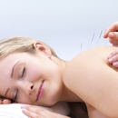 Accupuncture 4 U - Acupuncture