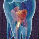 Temple Endodontics - Endodontists