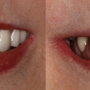 Dr. John Fish, DDS - Implant Dentistry