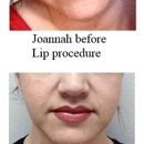 Permanent Makeup Beautiful You by Janice - Skin Care