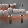 Smile on Implants Dental Centers gallery
