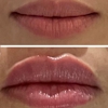 32 Beauty Med Spa gallery