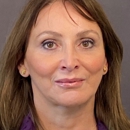 Andreja Packard, MD, Neurologist - Sleep Disorders-Information & Treatment