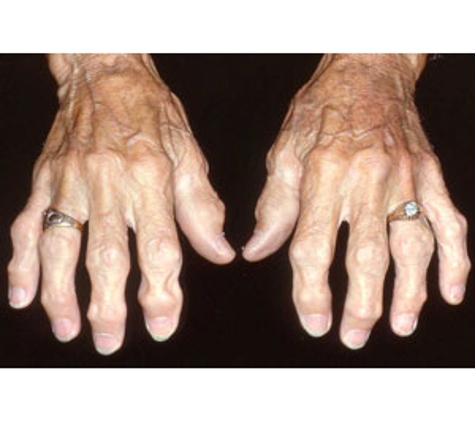 About Handz - Mitchelton, QLD