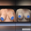 4 Beauty Aesthetics Institute for Plastic Surgery: Dr. Constantino Mendieta gallery