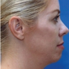 Facial Plastic Surgery Center gallery