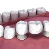 Crescent Family and Cosmetic Dentistry of Columbia gallery