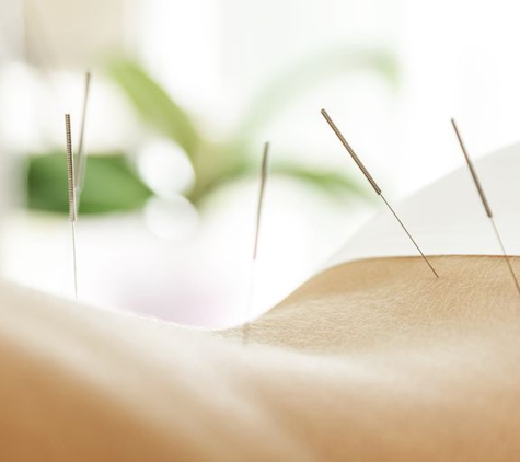 Tian Acupuncture - Miami, FL. Acupuncture for pain management!
