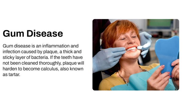 Heatherton Dental - Dandenong North, VIC. Gum Disease