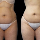 New York Group for Plastic Surgery - Day Spas