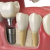 Sharma Oral Surgery Priveer D. Sharma DMD gallery