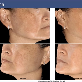 Clean Laser Clinics - Teneriffe, QLD