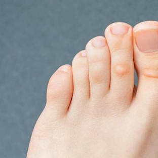 The Walking Clinic - Lyneham, ACT