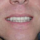 Augenstein Family Dentistry - Dental Clinics