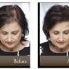 Hair  Replacment Associates gallery