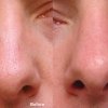 Levine, Donald T, MD gallery