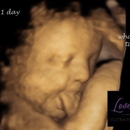 Love View 3D/4D Ultrasound Studio - MRI (Magnetic Resonance Imaging)