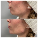 Blush Med Spa - Hair Removal