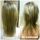 Hair Again Certified Hair Loss Specialists - Hair Replacement