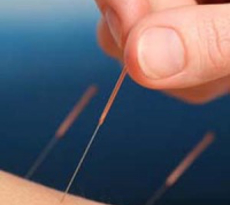 The Bon Accupuncture Clinic - Springwood, QLD. Acupuncture
