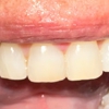 Cornerstone Family Dentistry-Morrison gallery