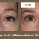 Klapper Eyelid & Facial - Physicians & Surgeons, Plastic & Reconstructive