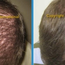 Hair Growth Clinic of CT - Clinics