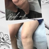 Vein Specialist Centers - Staten Island gallery