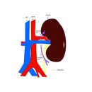 Bloomington Kidney & Hypertension Specialist PC - Physicians & Surgeons, Nephrology (Kidneys)