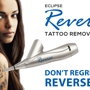 Skinovation | Tattoo Removal