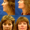Bunkis, Juris MD gallery