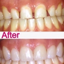 Roya Zandparsa, DDS, Msc, DMD @ Royal Dental Boston - Implant Dentistry