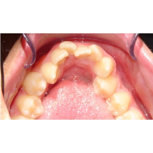 Active Orthodontics - Pialba, QLD