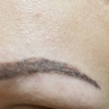 A Nurses Touch Brow Microblading and Electrolysis gallery