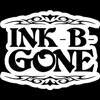 Ink-B-Gone Precision Laser Tattoo Removal gallery
