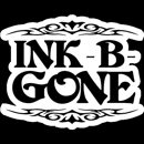 Ink-B-Gone Precision Laser Tattoo Removal - Tattoo Removal