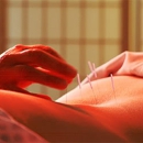 Citywide Chiropractic and Acupuncture - Acupuncture
