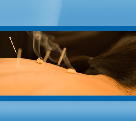 Physio Noosa. Acupuncture points are stimulated to create local, spinal segmental or supraspinal pain modulating effects.