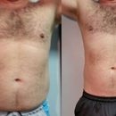 Lite Body Sculpting - Health Clubs