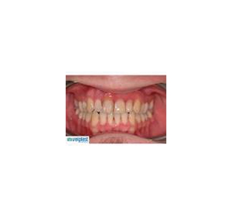 Affordable Denture Clinic - East Geelong, VIC