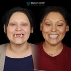 Smile Now Boise Dentures and Implants