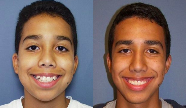 Kellyn Hodges Orthodontics - Bala Cynwyd, PA