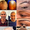 Scalp Designs gallery