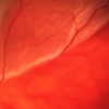 Retina Treatment Center gallery