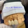 Usb Dental Lab gallery