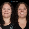 Smile Now Denver Dentures and Implants gallery