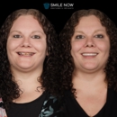 Smile Now Denver Dentures and Implants - Dentists